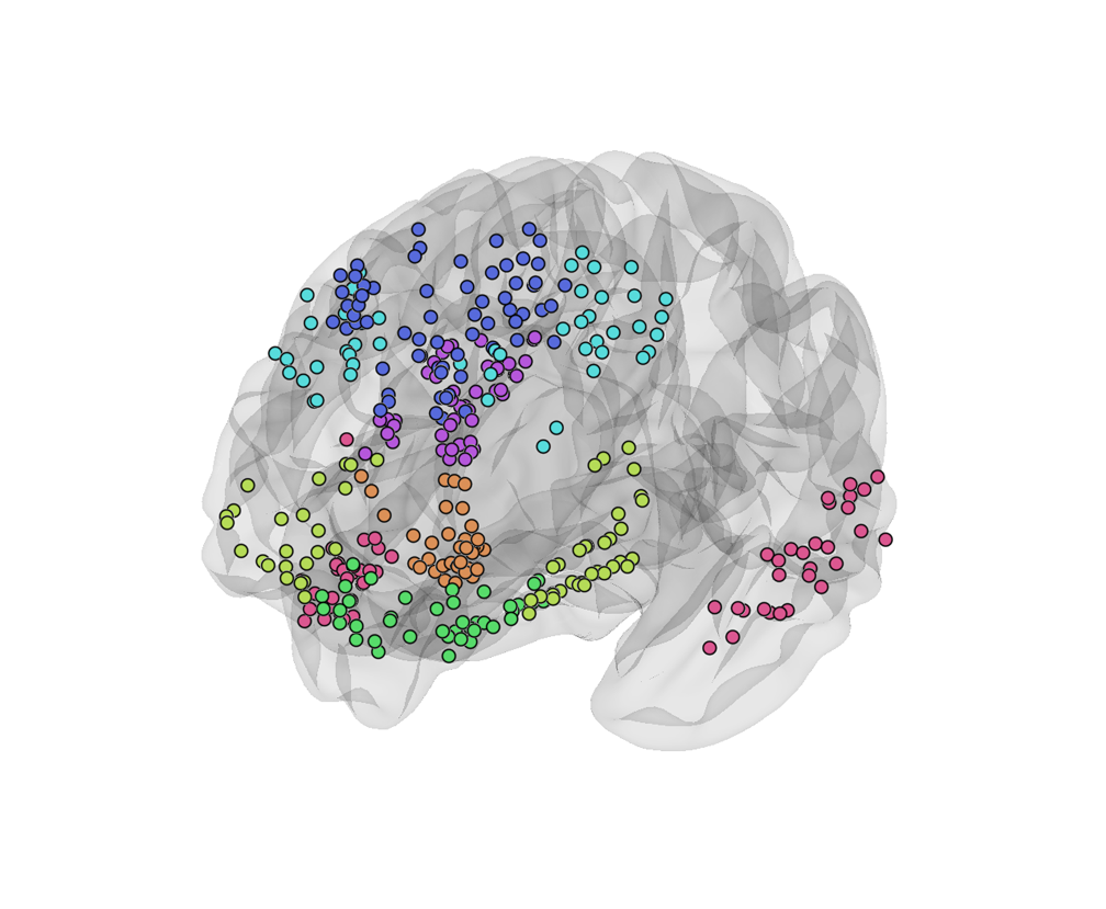 Shared intracranial neural dynamics underpinning joint social inference