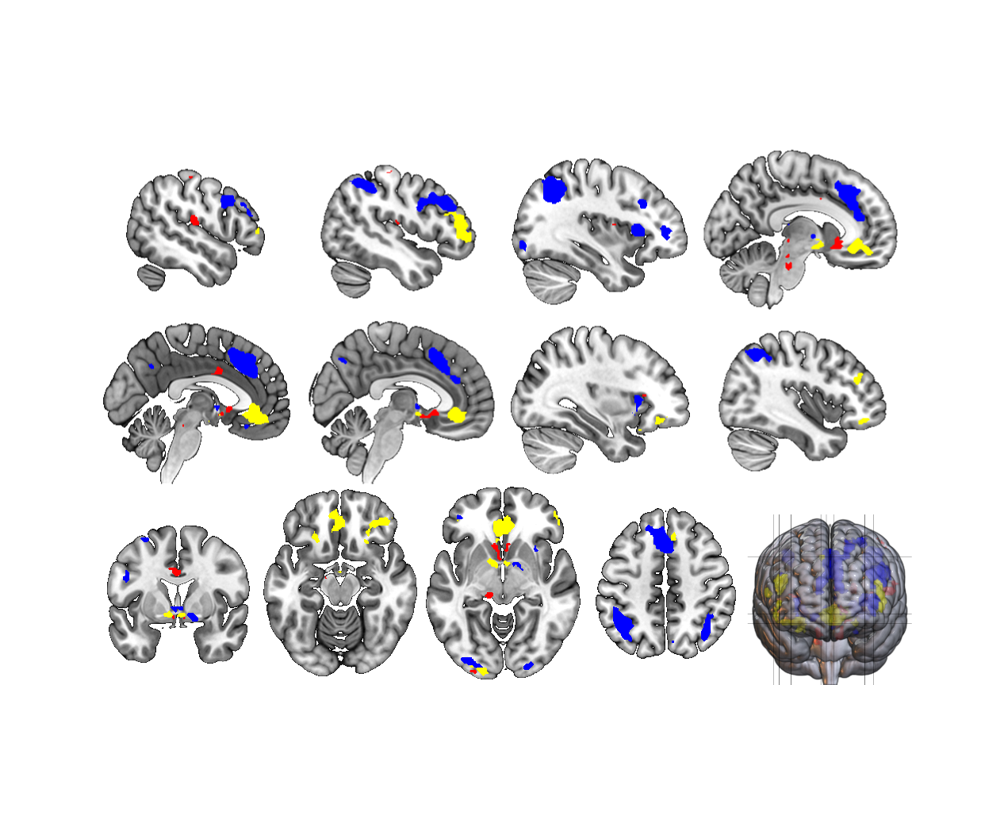 Individual differences in prosocial and antisocial learning